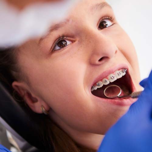 Orthodontics Treatment