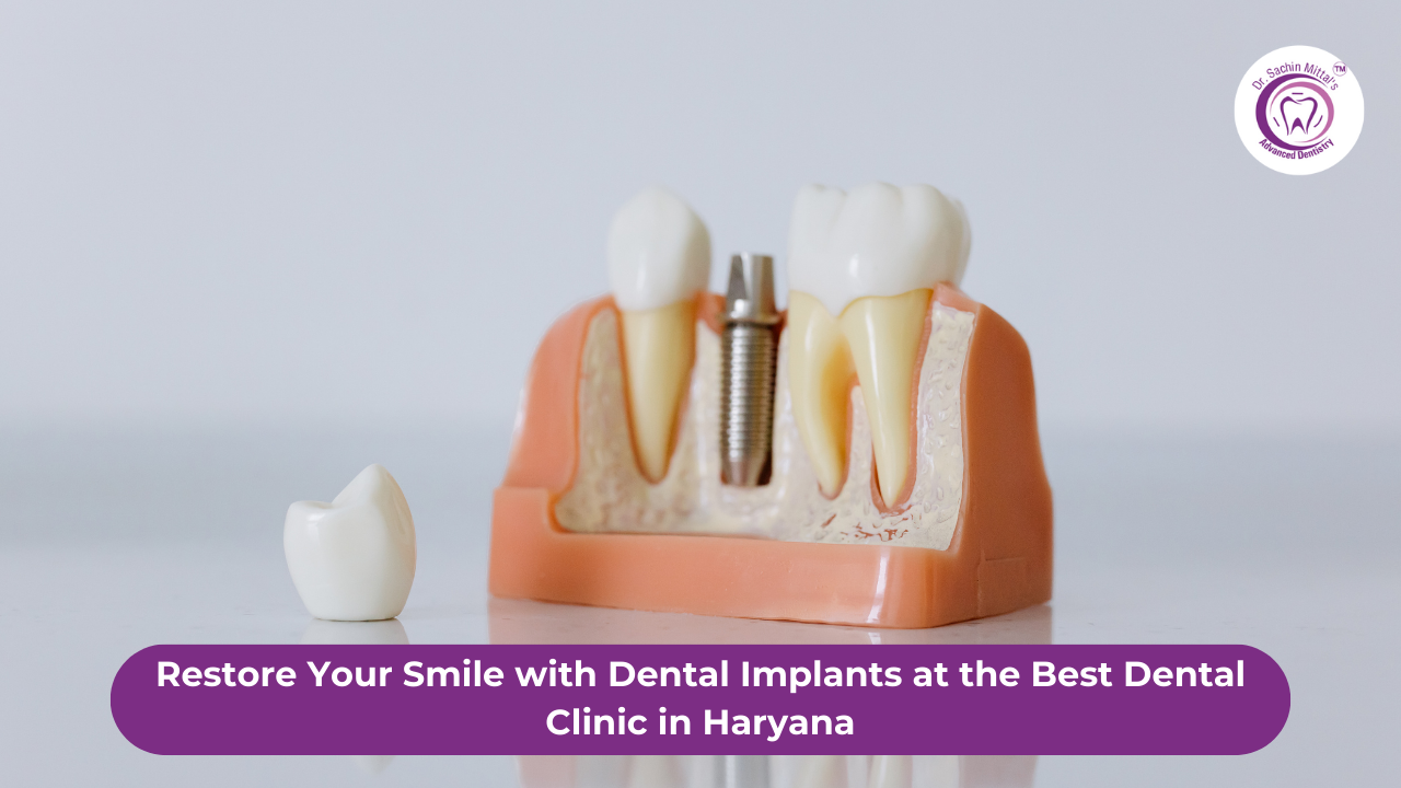 Restore Your Smile with Dental Implants at the Best Dental Clinic in Haryana