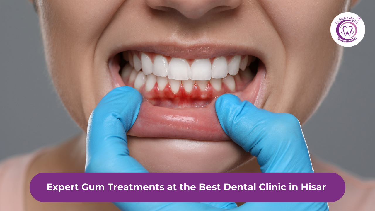 Expert Gum Treatments at the Best Dental Clinic in Hisar