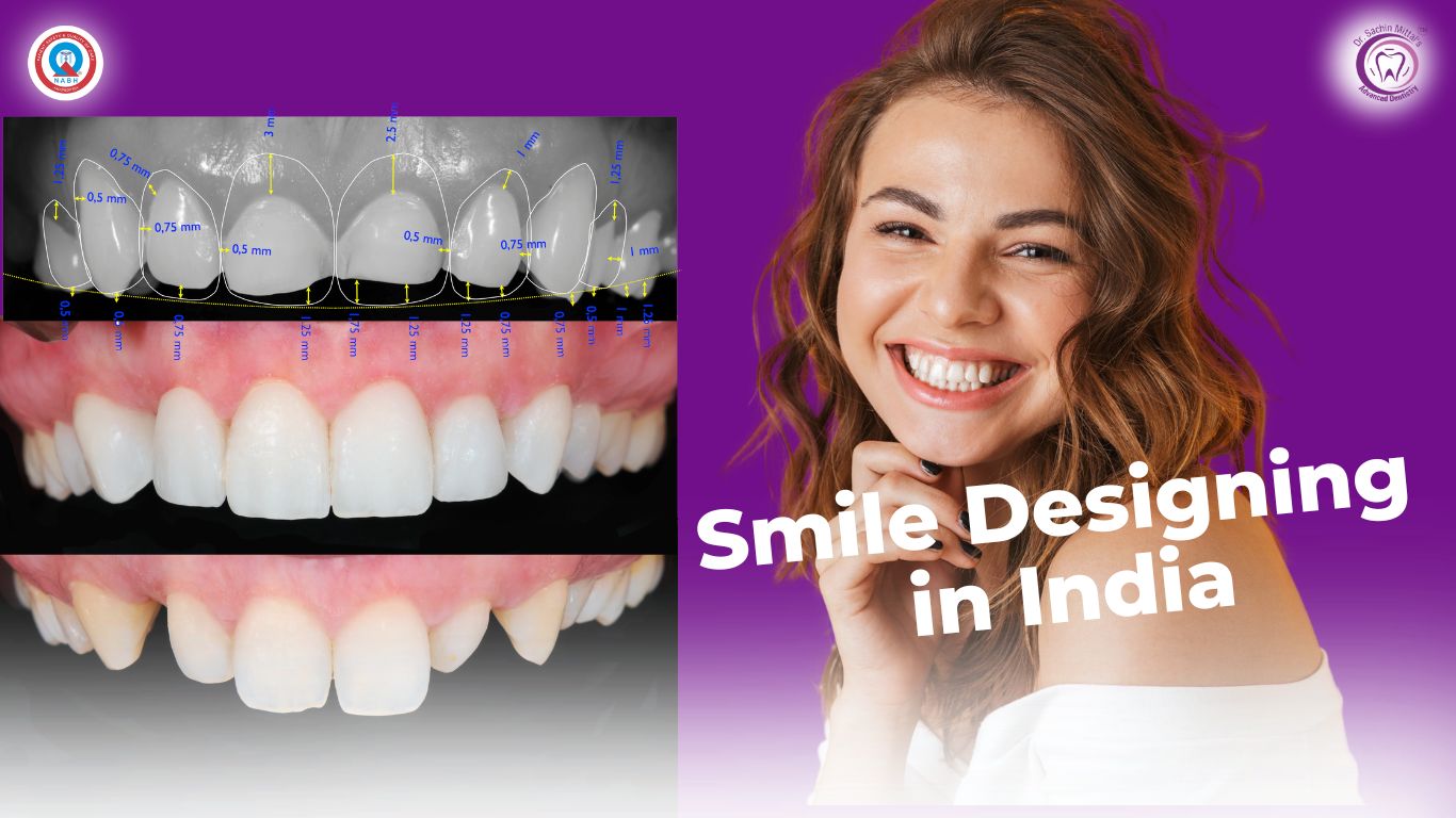 Smile Designing in India