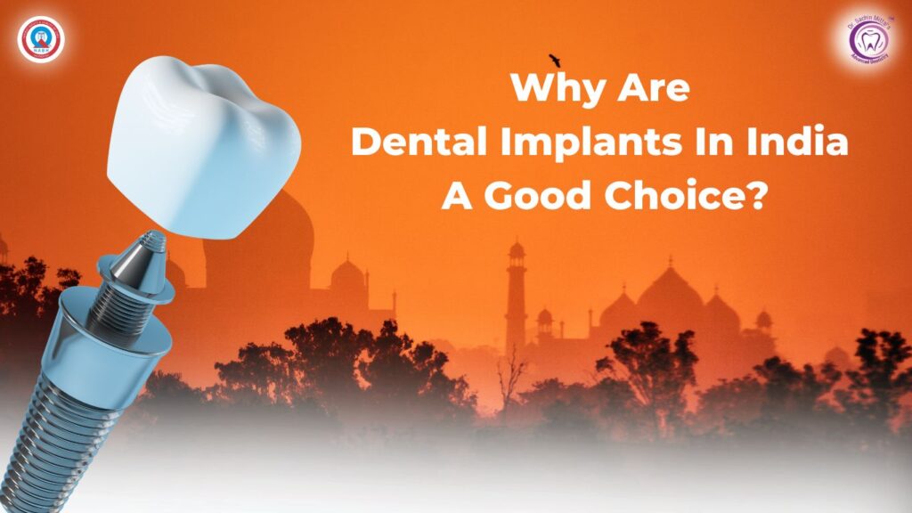 Dental Implant in India