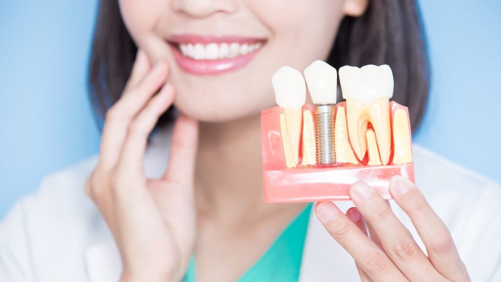 Dental Implant Myths vs Facts