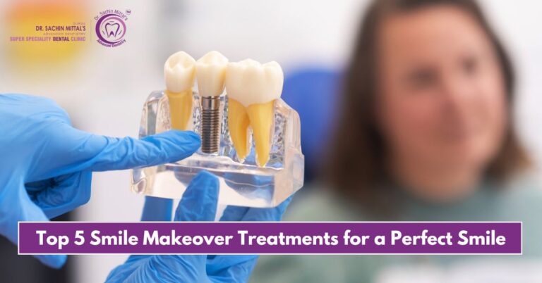 Top 5 Smile Makeover Treatments for a Perfect Smile
